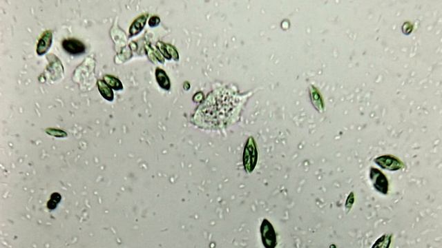 Amoeba sp. смотреть онлайн