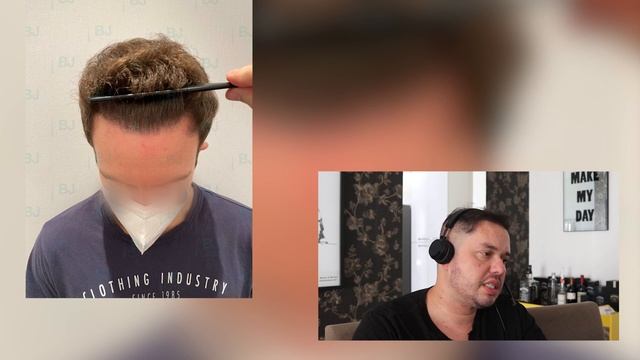 REACT 17 - DR BRUNO JACOBOVSKI TRANSPLANTE CAPILAR смотреть онлайн