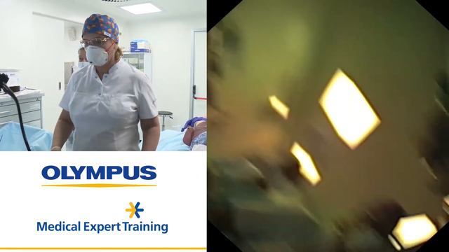 Эндоскопическая резекция карциномы желудка с помощью двухканального эндоскопа. Малихова О. А. смотреть онлайн