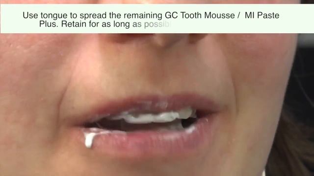Как использовать Tooth Mousse и Mi Paste Plus смотреть онлайн
