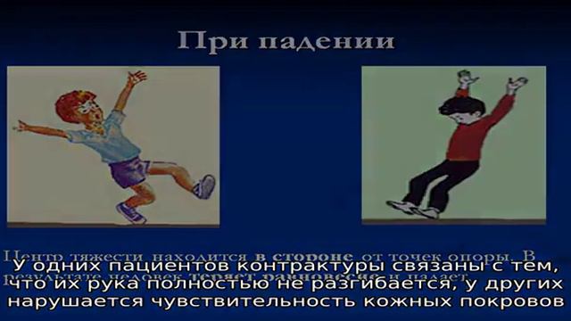 Вывих локтевого сустава смотреть онлайн