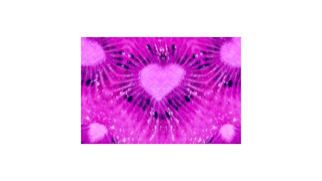 [FREE] Happy Trap Type Beat - Pink Kiwi (Avid Beats x Edien) смотреть онлайн