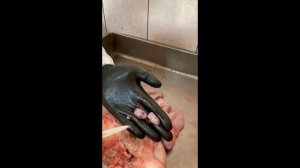 9 Гипофункция яичников