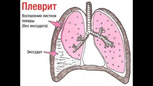 О каких заболеваниях говорит ОДЫШКА ?