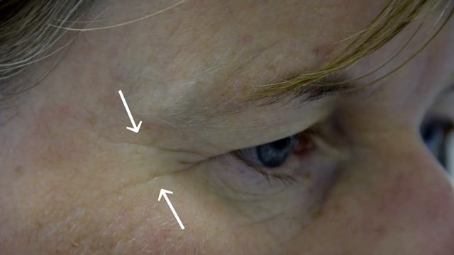 LIFTONIN®-XPRESS: Instant Lifting Effect | RAHN AG смотреть онлайн