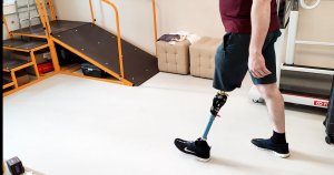 Пользователь протеза бедра из Донбасса