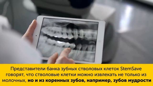 Почему не Стоит Выбрасывать Молочные Зубы смотреть онлайн