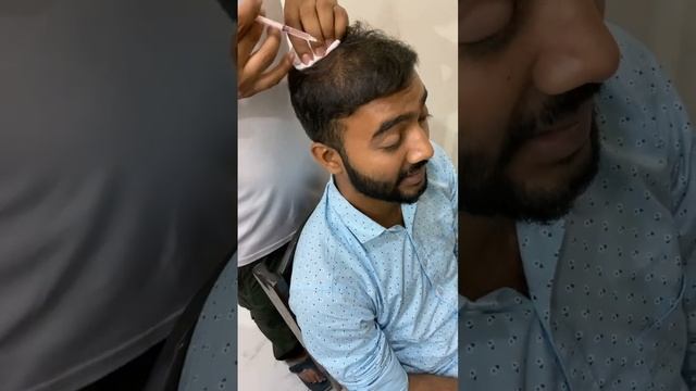 PRP treatment for hair loss dekhe kitna saa pain hota hai ?? life time chutty смотреть онлайн