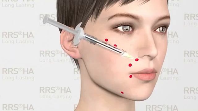 RRS HA Long Lasting - volumetrie, biorevitalizare, atenuarea ridurilor смотреть онлайн