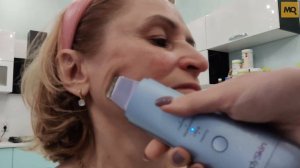 ReadySkin ZY8300 обзор. Аппарат для ультразвуковой чистки лица