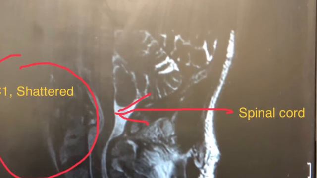 David Skudneski, Near Death Experience, NDE, X-rays смотреть онлайн