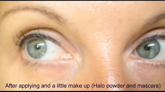 Puffy Eyes & Wrinkles - Transform Your Face In Five Minutes Or Less смотреть онлайн
