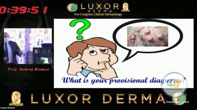 Uncommon scalp disorders : often Misdiagnosed by Dr Ashraf Hamza смотреть онлайн