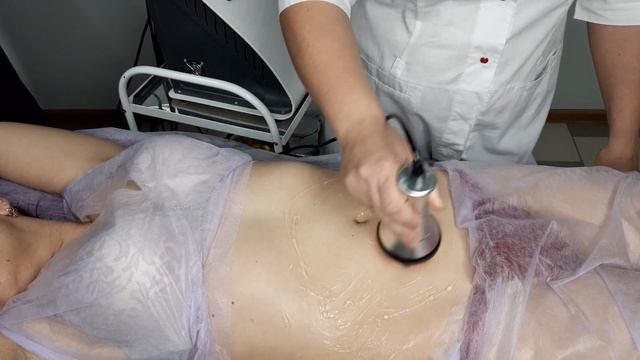 РФ лифтинг (обзор процедуры радиоволновой лифтинг тела) смотреть онлайн