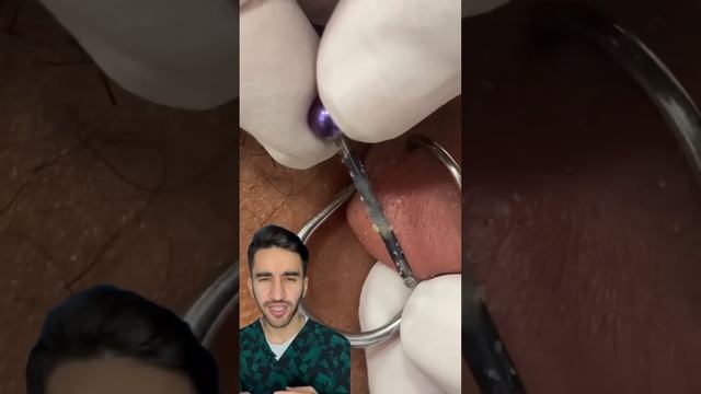 заживление после пирсинга смотреть онлайн