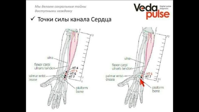 Канал Сердца, диагностика и методы воздействия смотреть онлайн