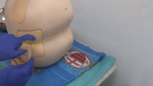 Постановка сифонной клизмы