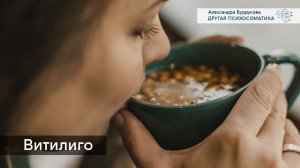 Витилиго. Психосоматика изменений на коже. Другая психосоматика