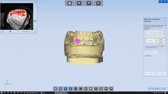 Artikulatorscan mit dem Shining 3D AutoScan DS MIX Bissgabelartikulation 1:1 virtuell übertragbar смотреть онлайн