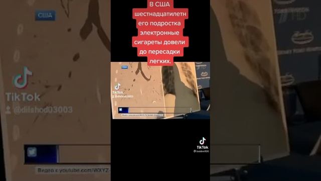 В Сша шетнсадцатилетн его подростка электронный сигареты давали до пересадки легких. смотреть онлайн
