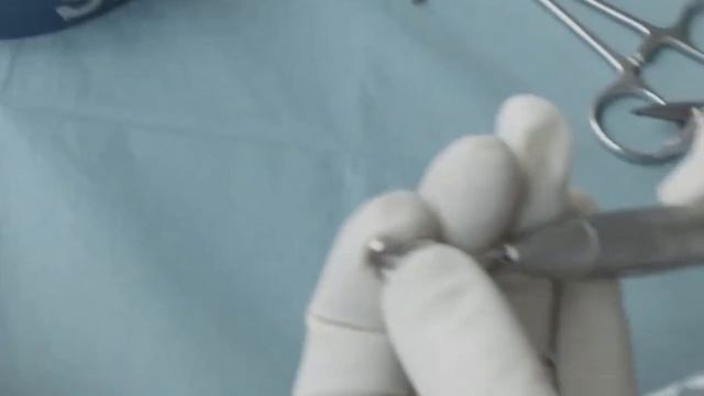 Implant PERSO-C avec moignon monobloc angulé de 30° - Per смотреть онлайн