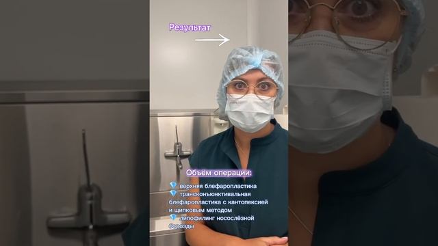 Круговая блефаропластика