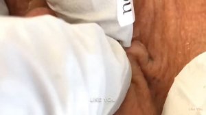 Выдавливание чёрных точек НОВОЕ! Удаление чёрных точек за ухом. Чистка лица. Прыщи - выдавливание!