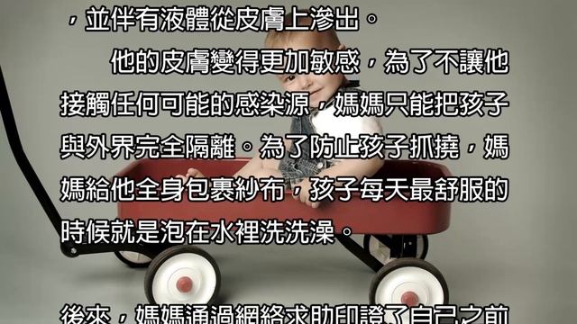 嬰兒濕疹千萬別這樣治，寶寶滿臉紅疹怎麼辦,新生兒紅疹預防手冊,嬰兒濕疹治療方法|育兒秘籍|寶寶|母嬰|小甜筒|警示錄|嬰兒|babycare|LoveBaby愛貝貝