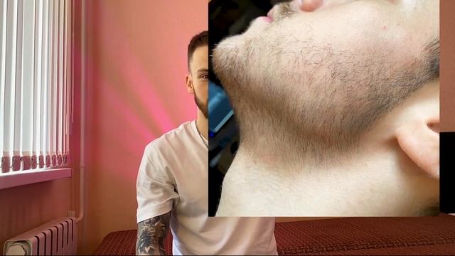 Миноксидил для бороды | Как отрастить бороду? | Все о миноксидиле. | Полная инструкция.