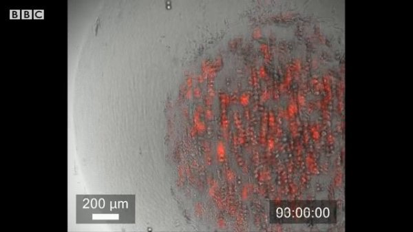 The Future of Organ Transplants: 3D Printing Technology