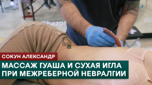 Массаж гуаша и сухая игла при межреберной невралгии. Сокун Александр