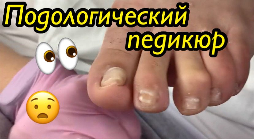 Подологический педикюр????❗️ смотреть онлайн
