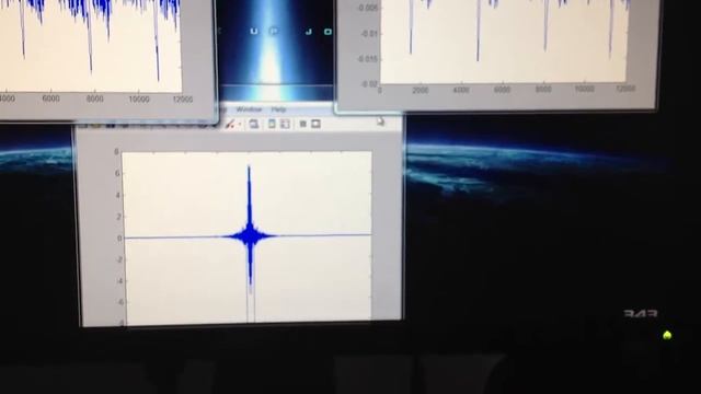 DIY ECG SIGNAL with MATLAB смотреть онлайн