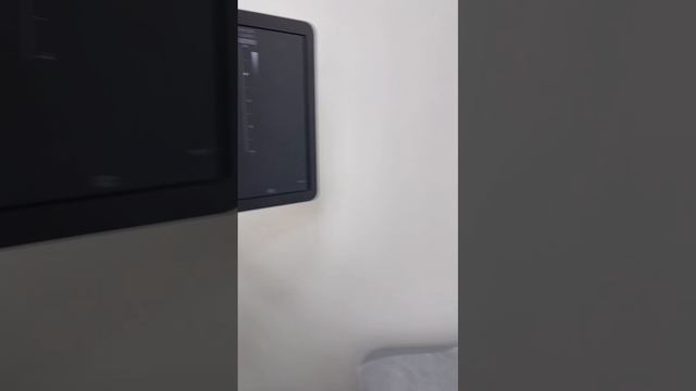 Варикозные вены на ноге. Как лечить варикоз? Флеболог Москва. Флеболог. Сосудистый хирург смотреть онлайн