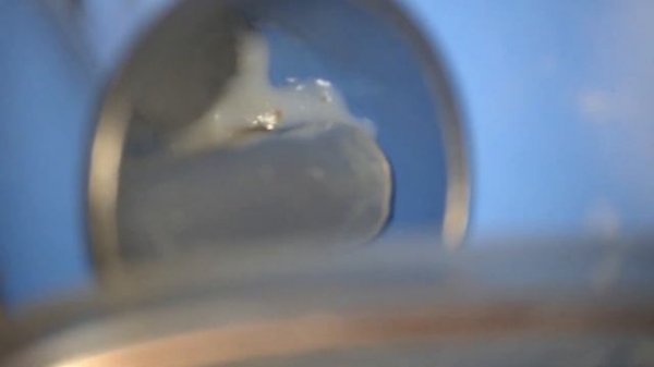 Распломбировка гуттаперчи системой protaper retreatment и soco