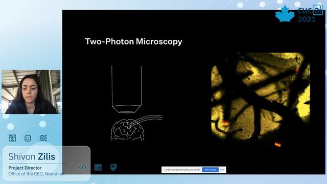 The Future Of Brain Machine Interfaces - Shivon Zilis, Project Director At Neuralink | CUCAI 2021