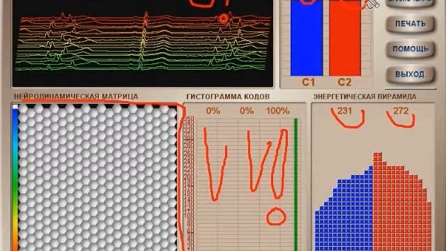 Результаты применения ионизатора Сферион часть 3 смотреть онлайн