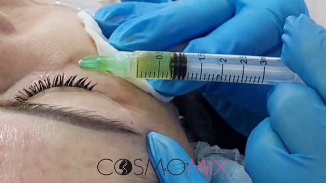 Плазмолифтинг лица смотреть онлайн