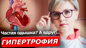 ГИПЕРТРОФИЯ ЛЕВОГО ЖЕЛУДОЧКА | Поговорим о сердце