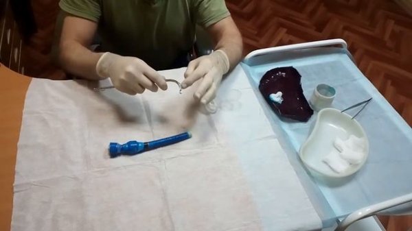 Катетеризация жестким катетером (Мужской)