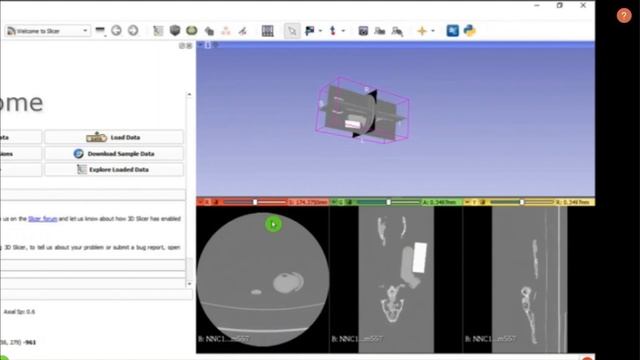 Club 2, Tutorial 8. Organ Segmentation 3D Slicer смотреть онлайн