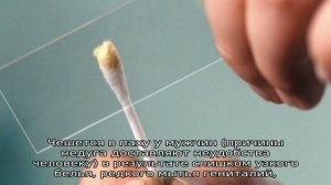 Чешется в паху у мужчин. Причины зуда по ночам, аллергический, раздражение, опрелость. Лечение