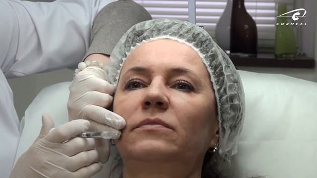 Коррекция нижней трети лица