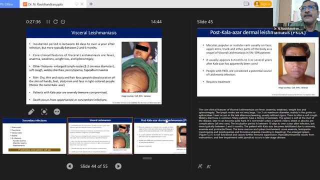 RDLS | South Region| HIV & Co-infections Hepatitis & Leishmaniasis | Dr. N Ravichandran | 25-04-202 смотреть онлайн