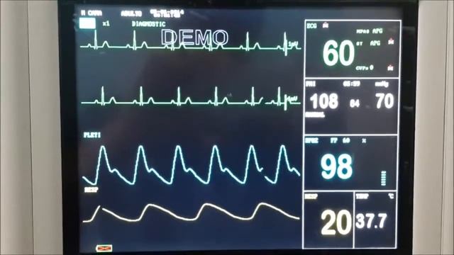 MEC 1000 смотреть онлайн
