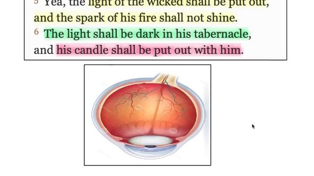 The Black Eye Club (pt1) смотреть онлайн