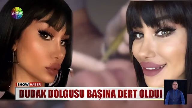 Dudak dolgusu başına dert oldu! смотреть онлайн