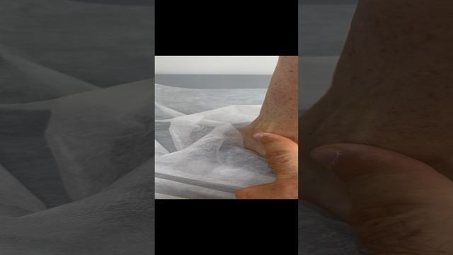 Пациентке предложили операцию по удалению здоровой вены. Узи. Сосудистый хирург. Флеболог Москва смотреть онлайн