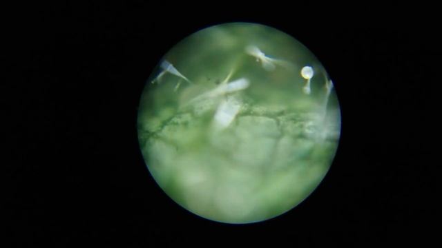 Как Опредилить наличие Клеща - без Микроскопа смотреть онлайн