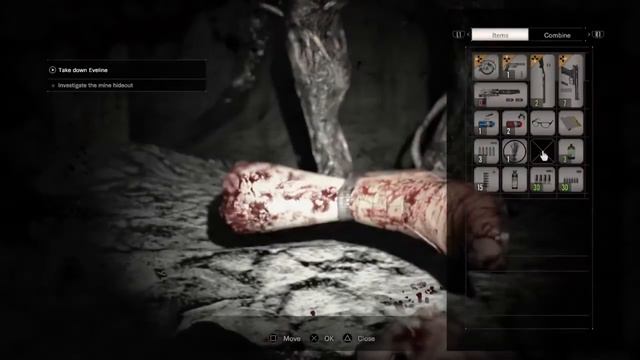 RESIDENT EVIL 7 Biohazard Gold Edition Molded Amputates Leg смотреть онлайн